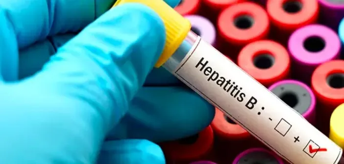 Hepatitis B