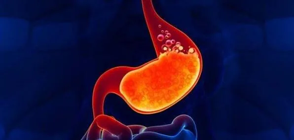 Penyakit Refluks Asam Lambung (GERD)