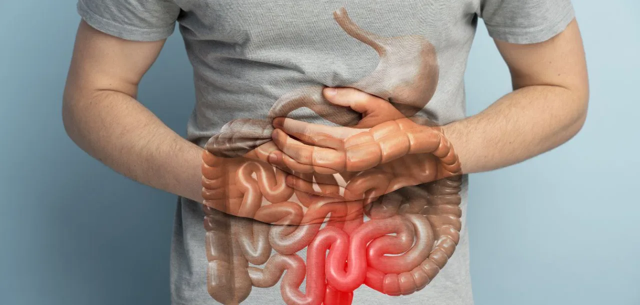 Radang Usus Buntu (Apendisitis)