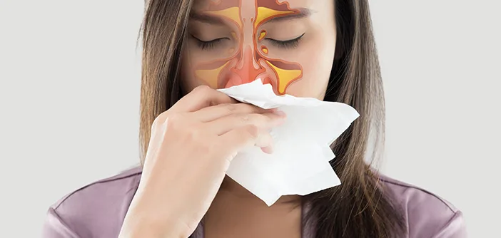 Sinusitis