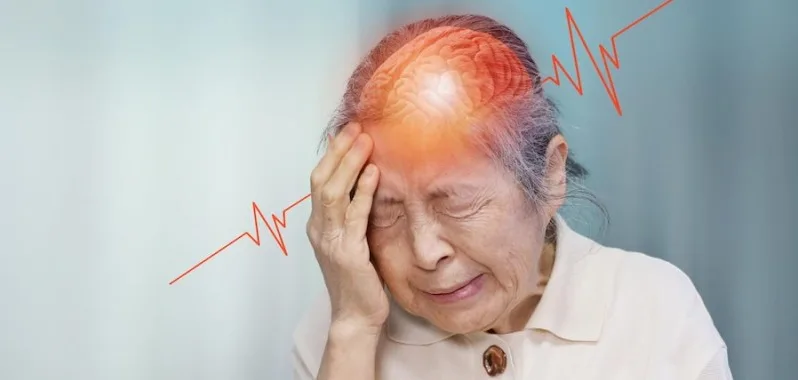Stroke